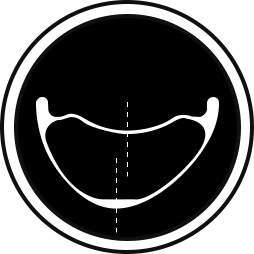 ARP-asymmetric-rim-design-tech-logo-20190830